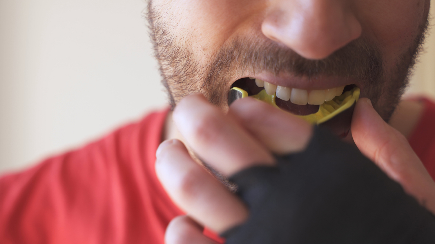 Young male putting in professional mouthguard before boxing sparring training