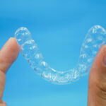Clear Aligners Can Make Your Teeth Straight And Are More Effective Than Braces